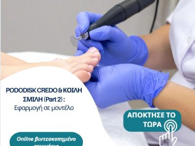 part2 PODODISK CREDO & ΚΟΙΛΗ ΣΜΙΛΗ (Part 2): Εφαρμογή σε μοντέλο.